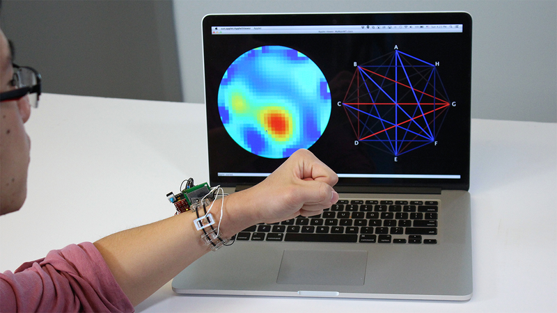 Illustration for article titled This Smartwatch Detects Gestures By Watching the Muscles Inside Your Arm Move